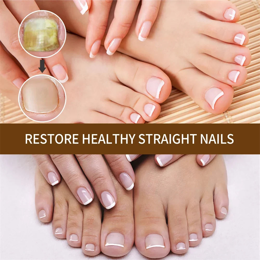30ml Nail Organic DeepHealing Growth 2pcs Serum