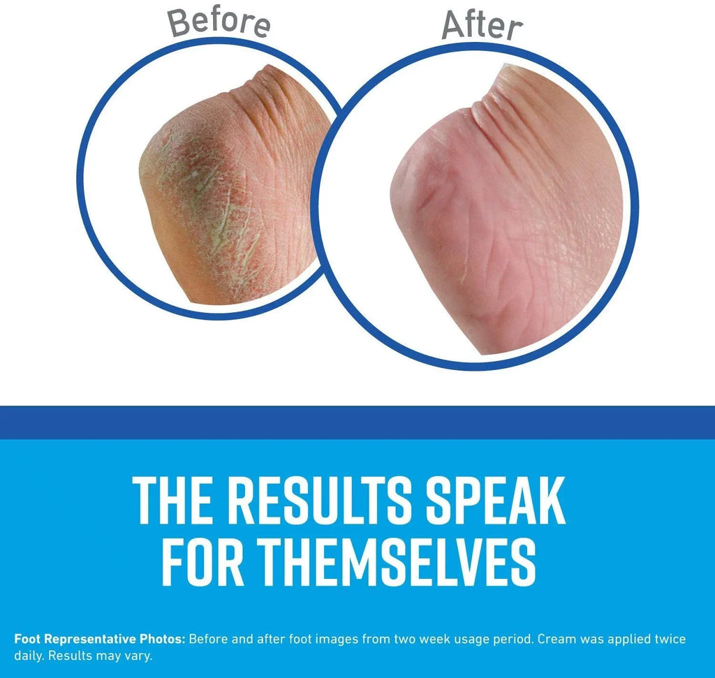 of Feet Cream, , Pack Foot 8 O'Keeffe's ounce Healthy 3.0